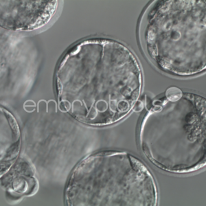 Products for IVF laboratories