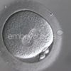 02 - Un aperçu des techniques de FIV – Image 4