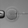09 - Piezo-actuated intracytoplasmic sperm injection